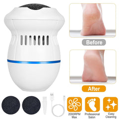 Electric Foot  Callus Remover